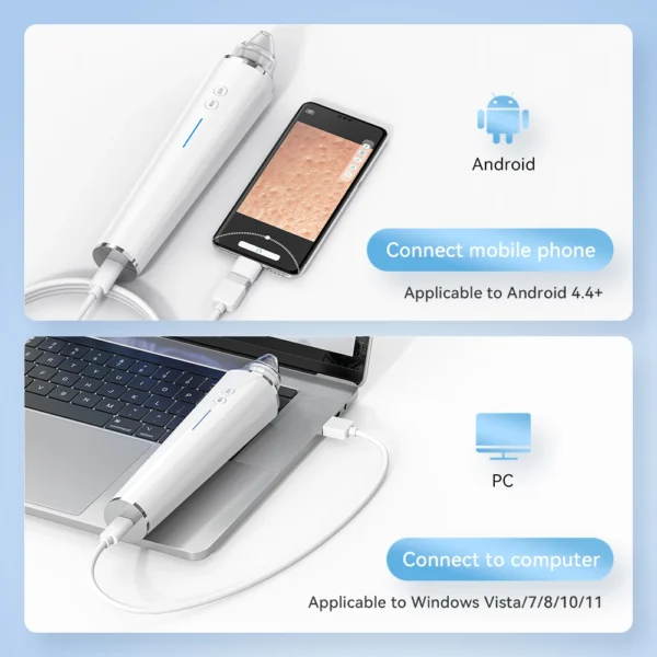 Professional Electric Pore Vacuum - Blackhead & Acne Removal Deep Cleansing Machine - Image 6