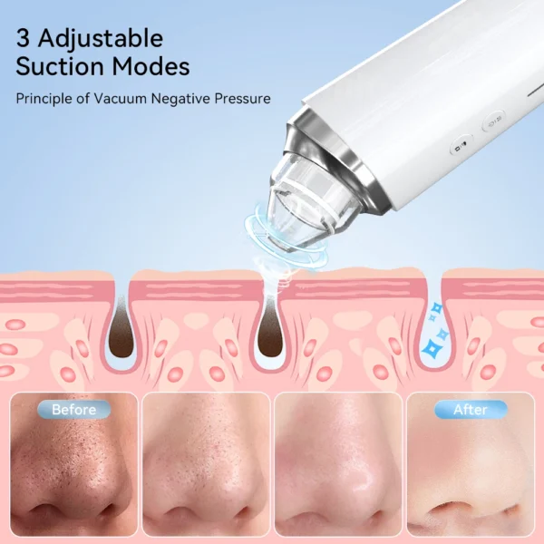 Professional Electric Pore Vacuum - Blackhead & Acne Removal Deep Cleansing Machine - Image 3