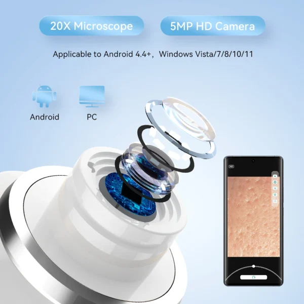 Professional Electric Pore Vacuum - Blackhead & Acne Removal Deep Cleansing Machine - Image 2
